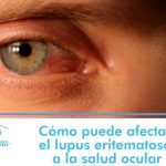 la-iridologia-y-su-relacion-con-la-salud-de-los-ojos-y-la-vision